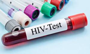COVID-19 on HIV/AIDS